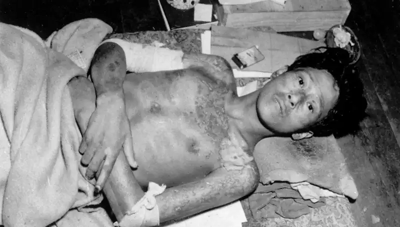 80 Yıl Sonra Nagasaki’den Gelen Alarm: Nükleer Tehdit Yeniden Gündemde