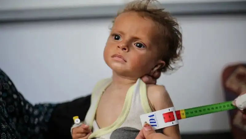 İngiltere, 300 Gazzeli Çocuğa Yeni Bir Yaşam Fırsatı Sunuyor